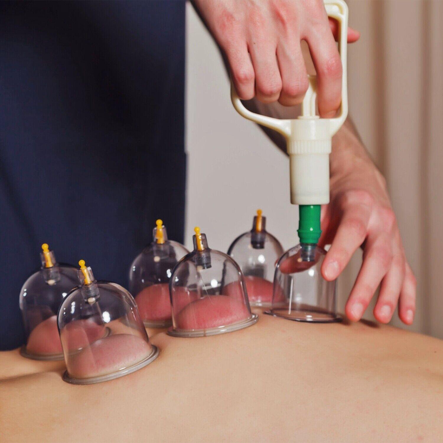 Silicone Cupping Massage
