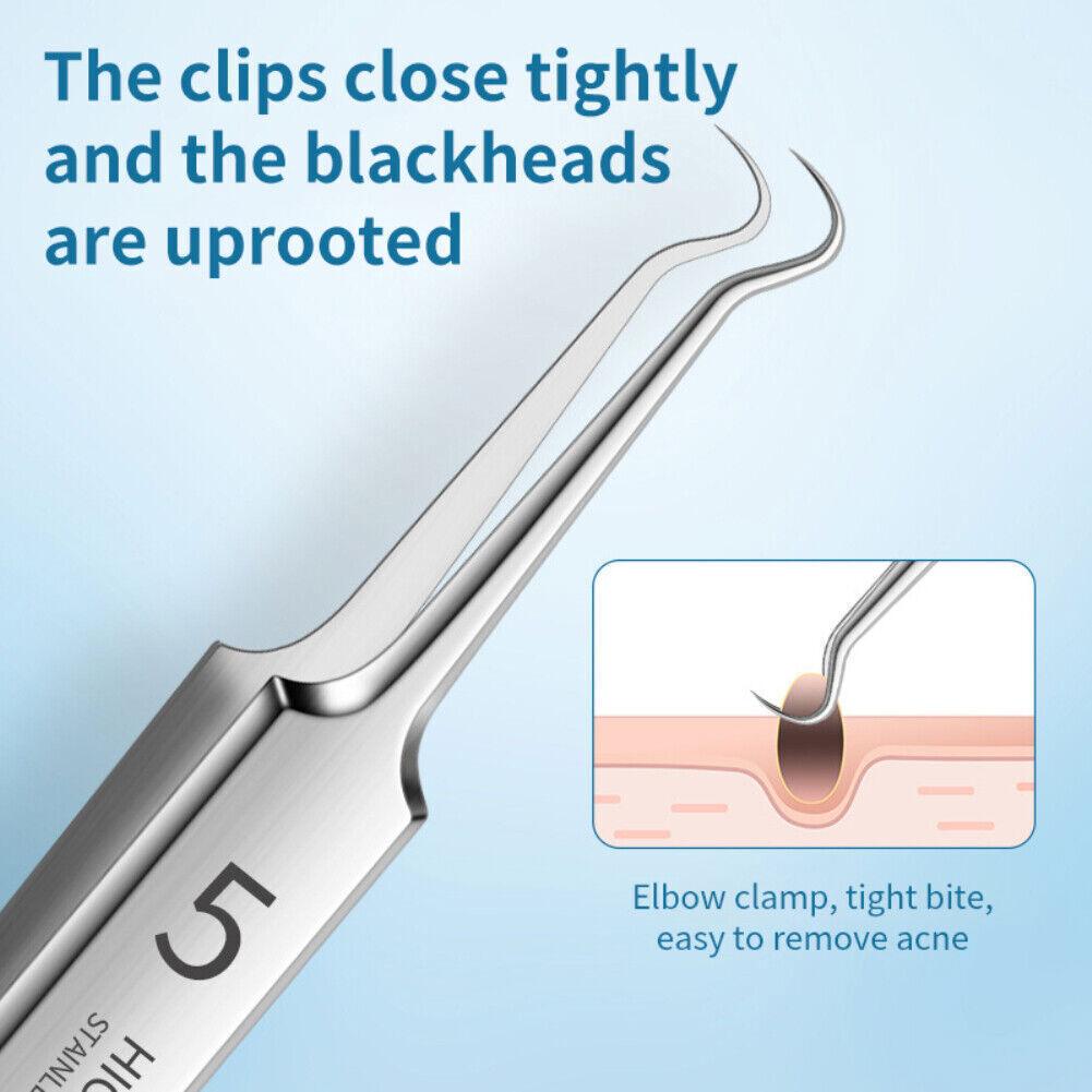 Blackhead Remover Needle - Pimple Blemish Comedone Extractor Tweezer Tool