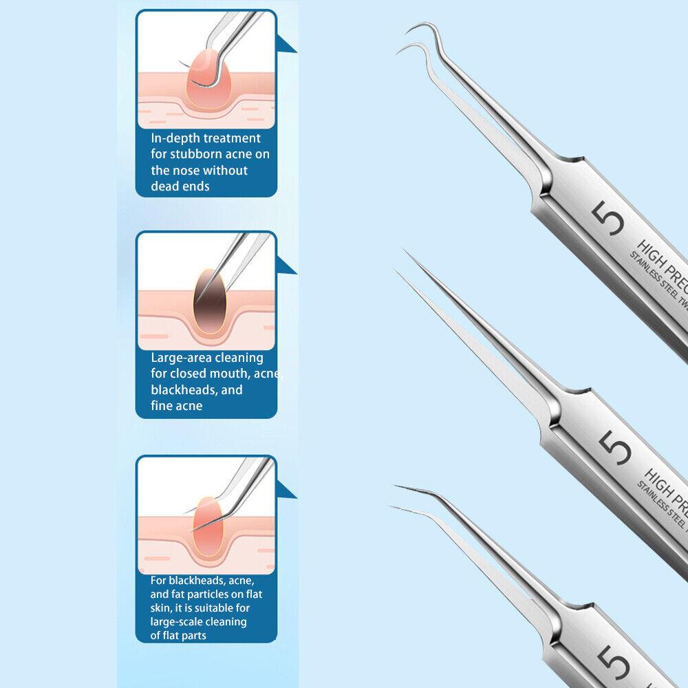 Blackhead Remover Needle - Pimple Blemish Comedone Extractor Tweezer Tool