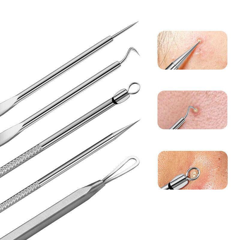 Blackhead Remover Needle - Pimple Blemish Comedone Extractor Tweezer Tool