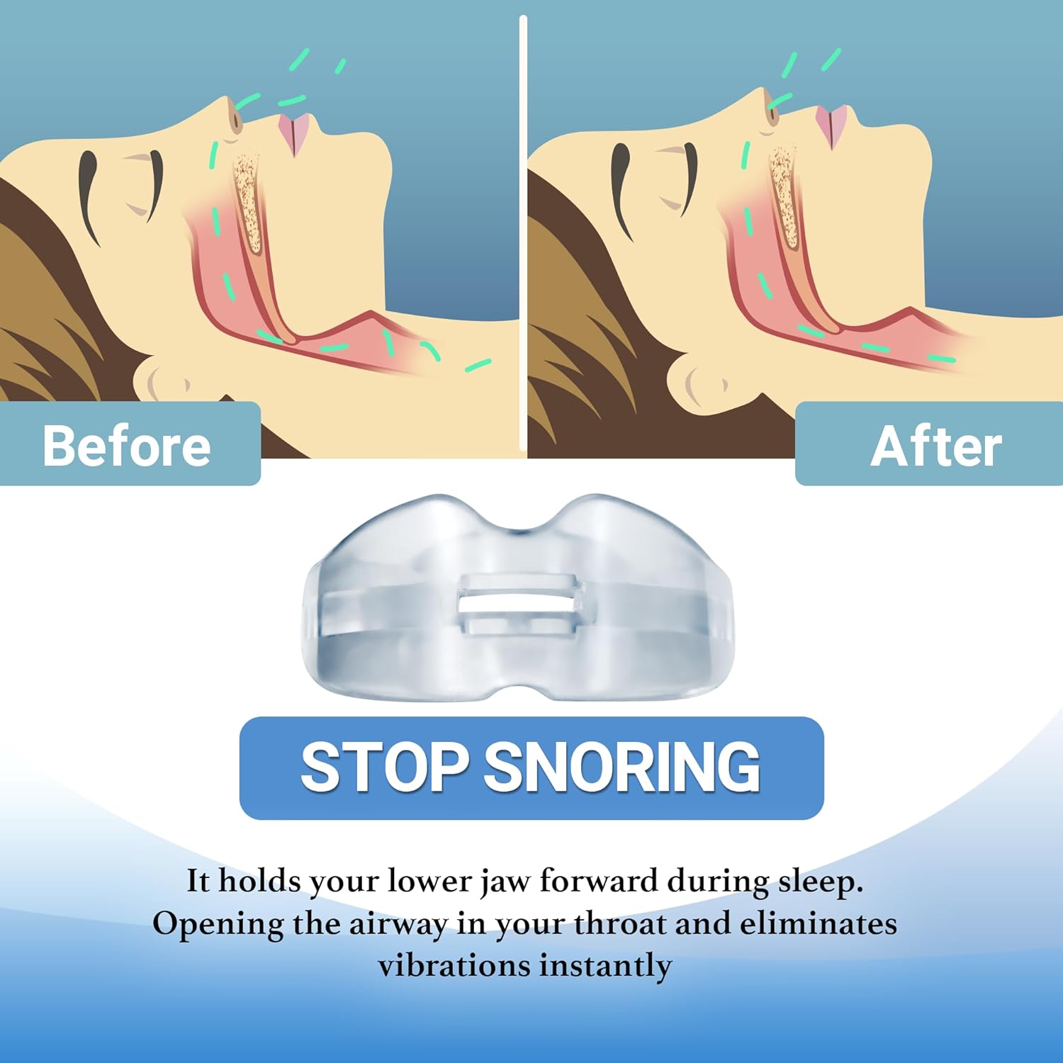 	 best anti snore device