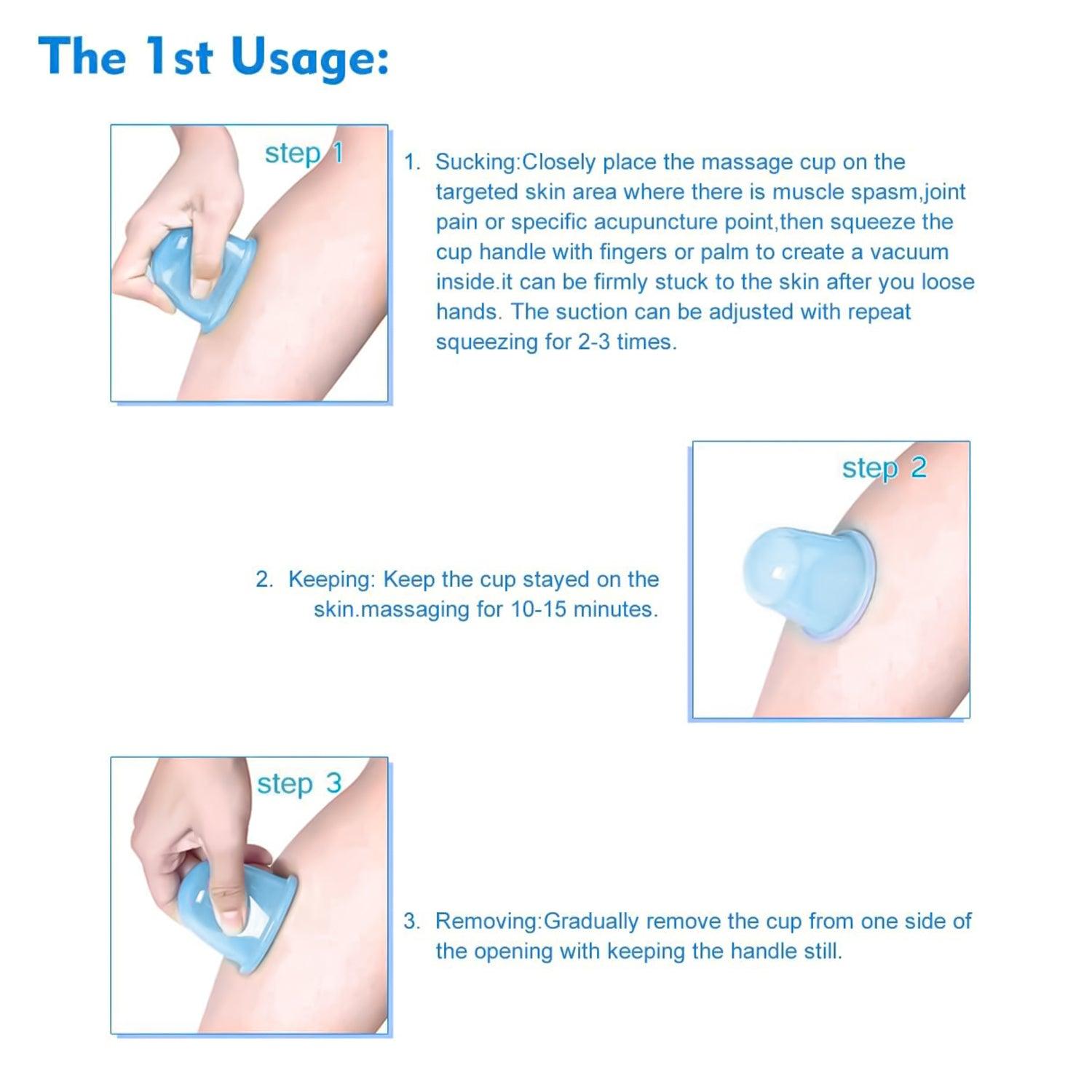 Silicone Cupping Set