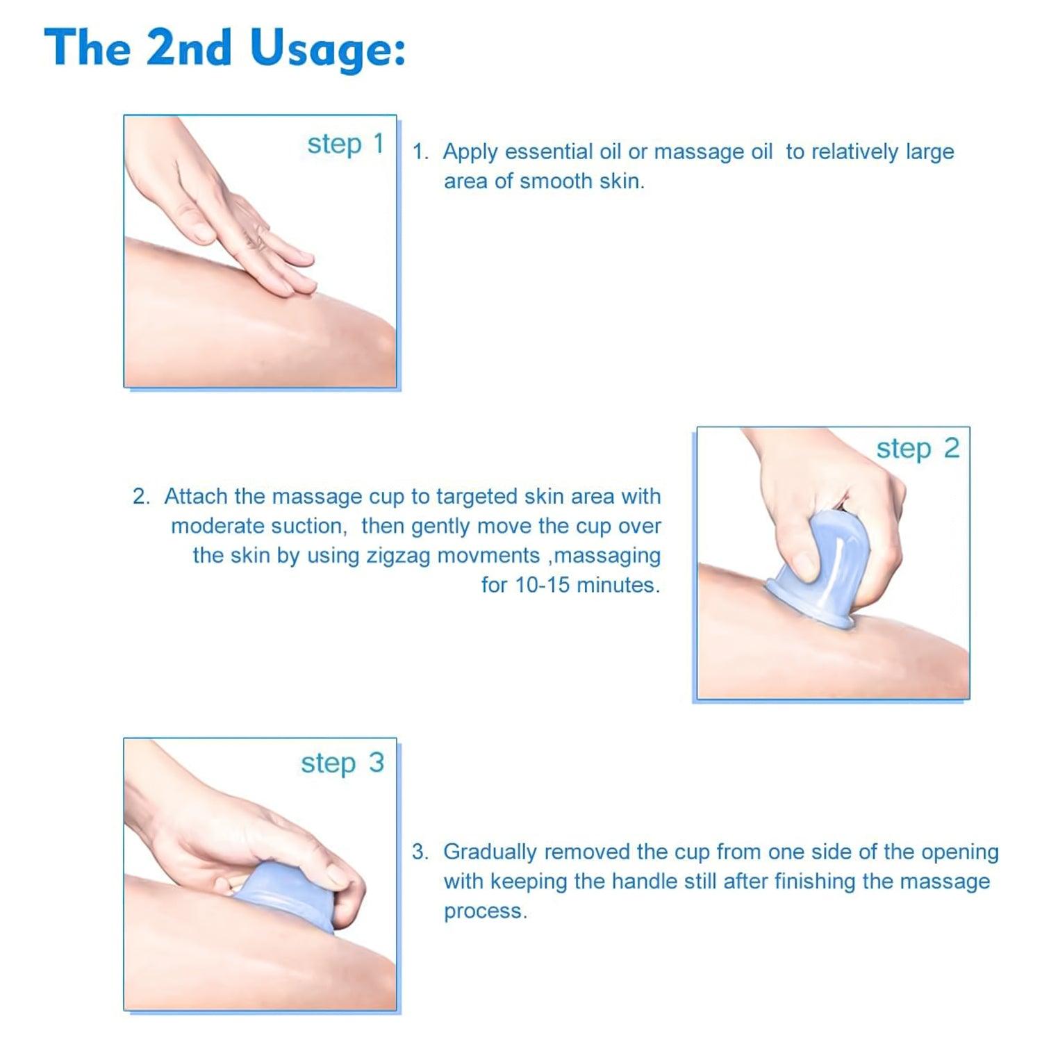 Silicone Cupping Set