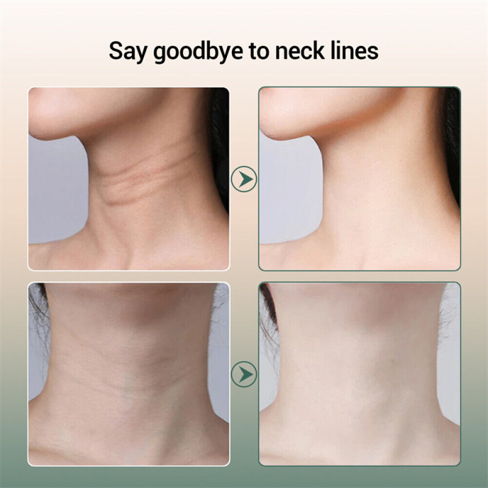 Neck Wrinkles with Creams