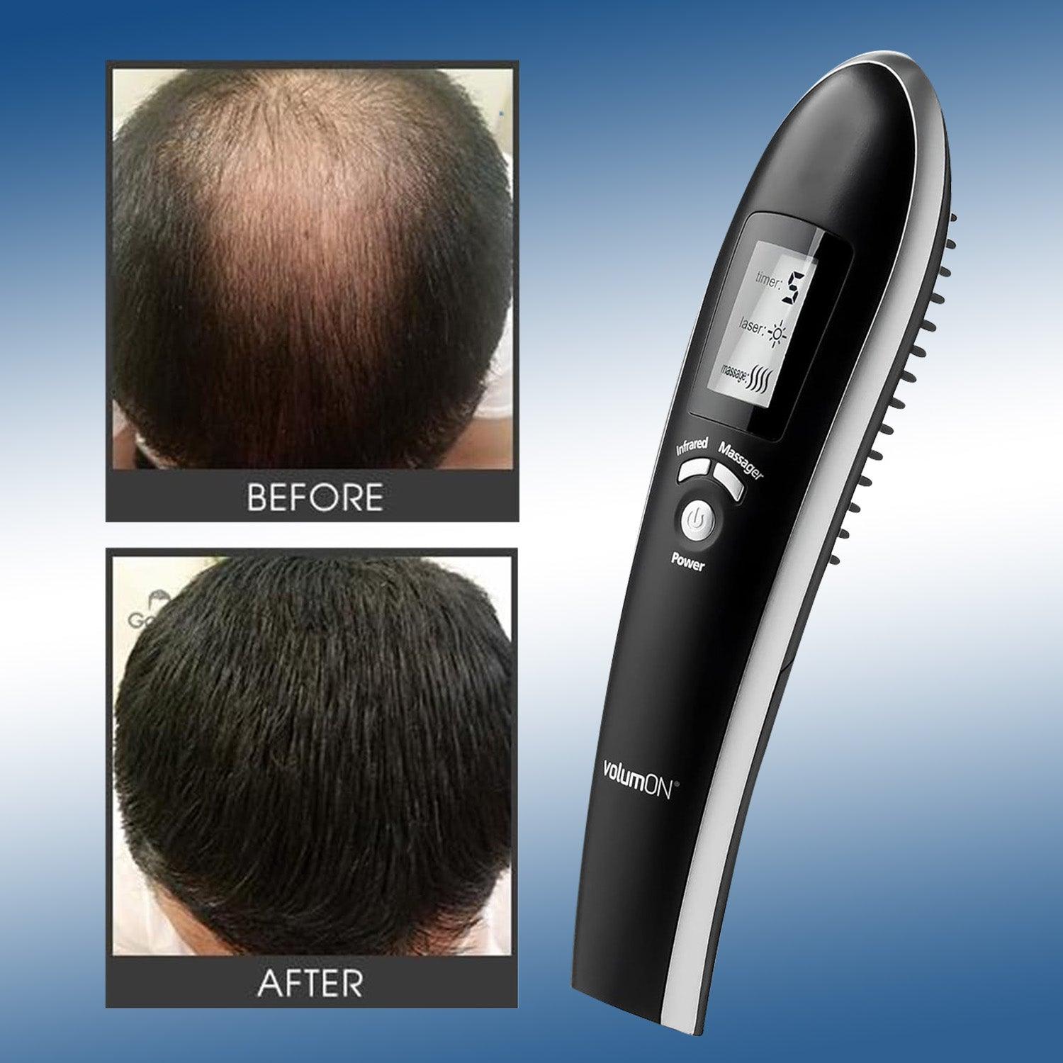 Hair Growth Laser Comb
