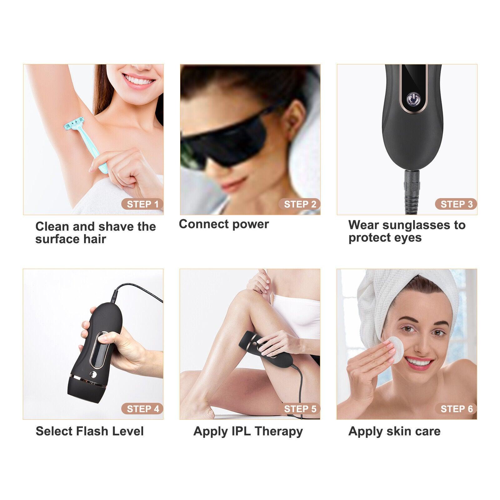laser hair removal machines