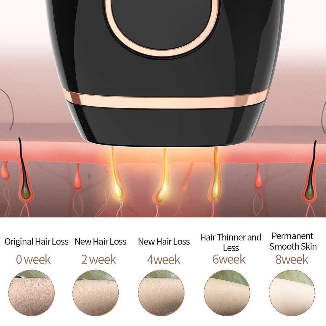 price of laser hair removal machine
