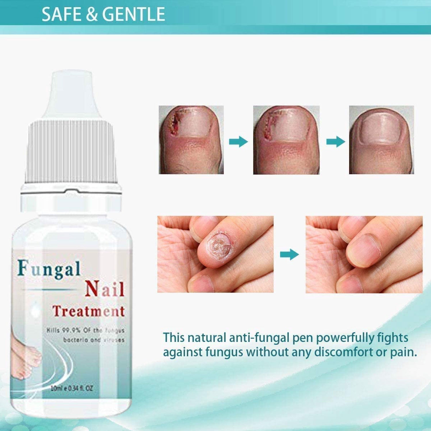 Anti fungal Nail Solution