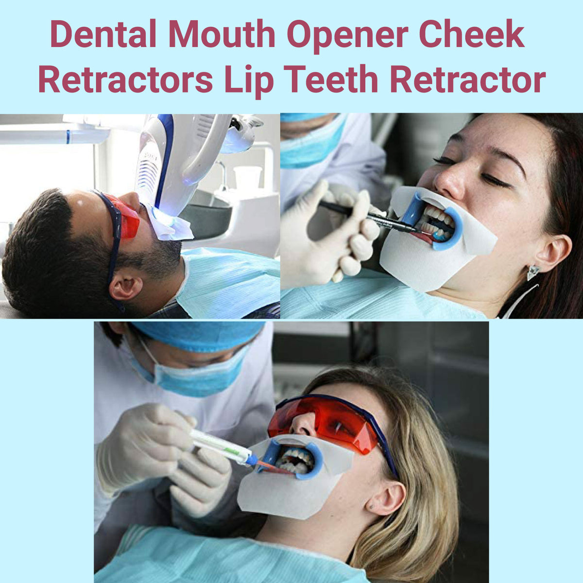 dental retractor use