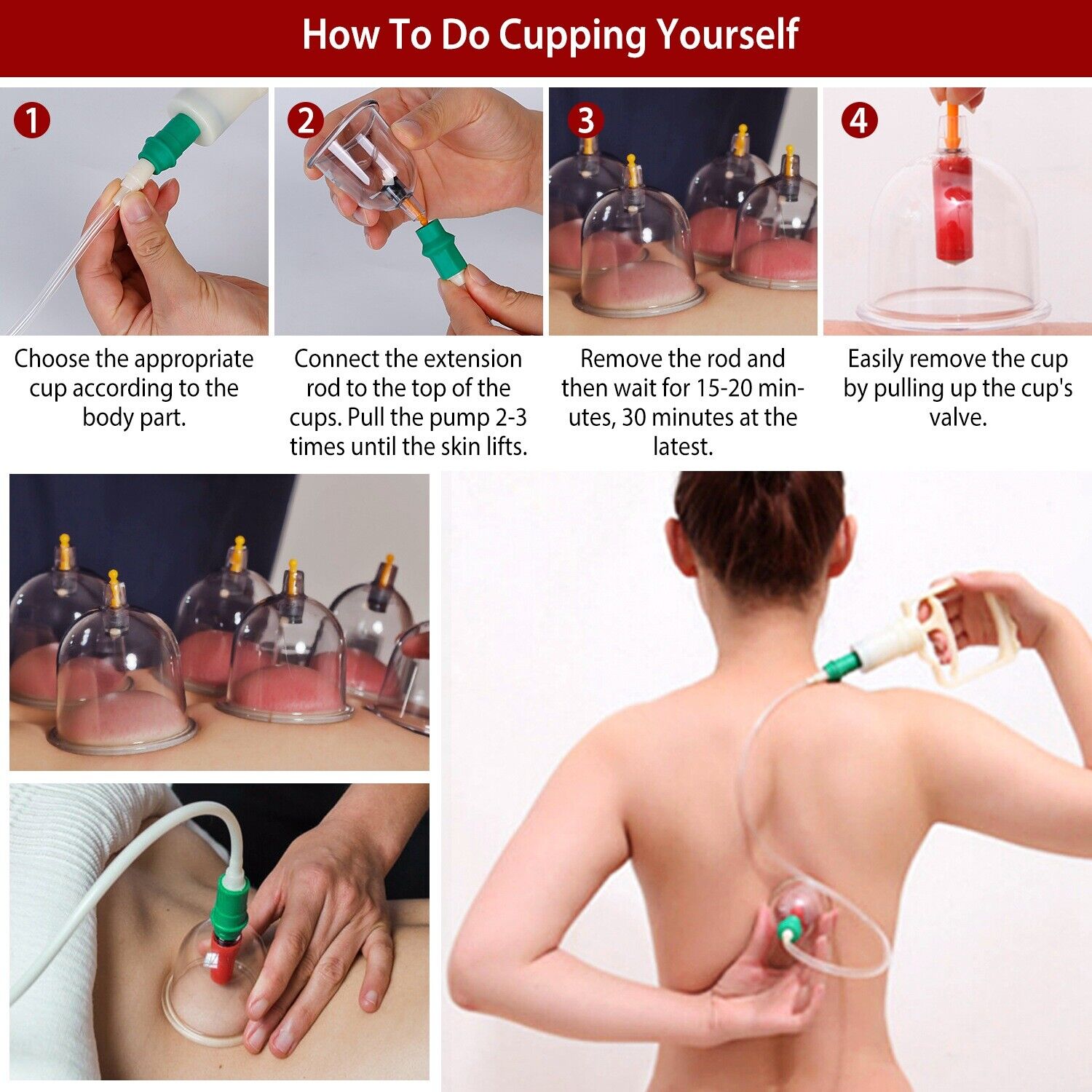Cupping Set Silicone