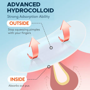 Hydrocolloid Patches for Face