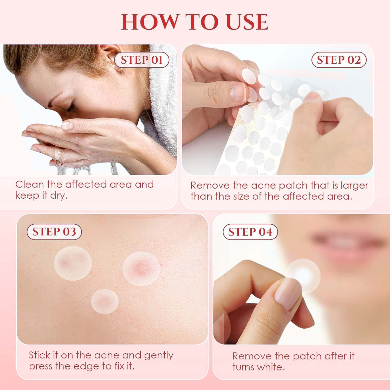 Acne Healing Dots