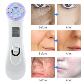 Skin Tightening Machine for Face