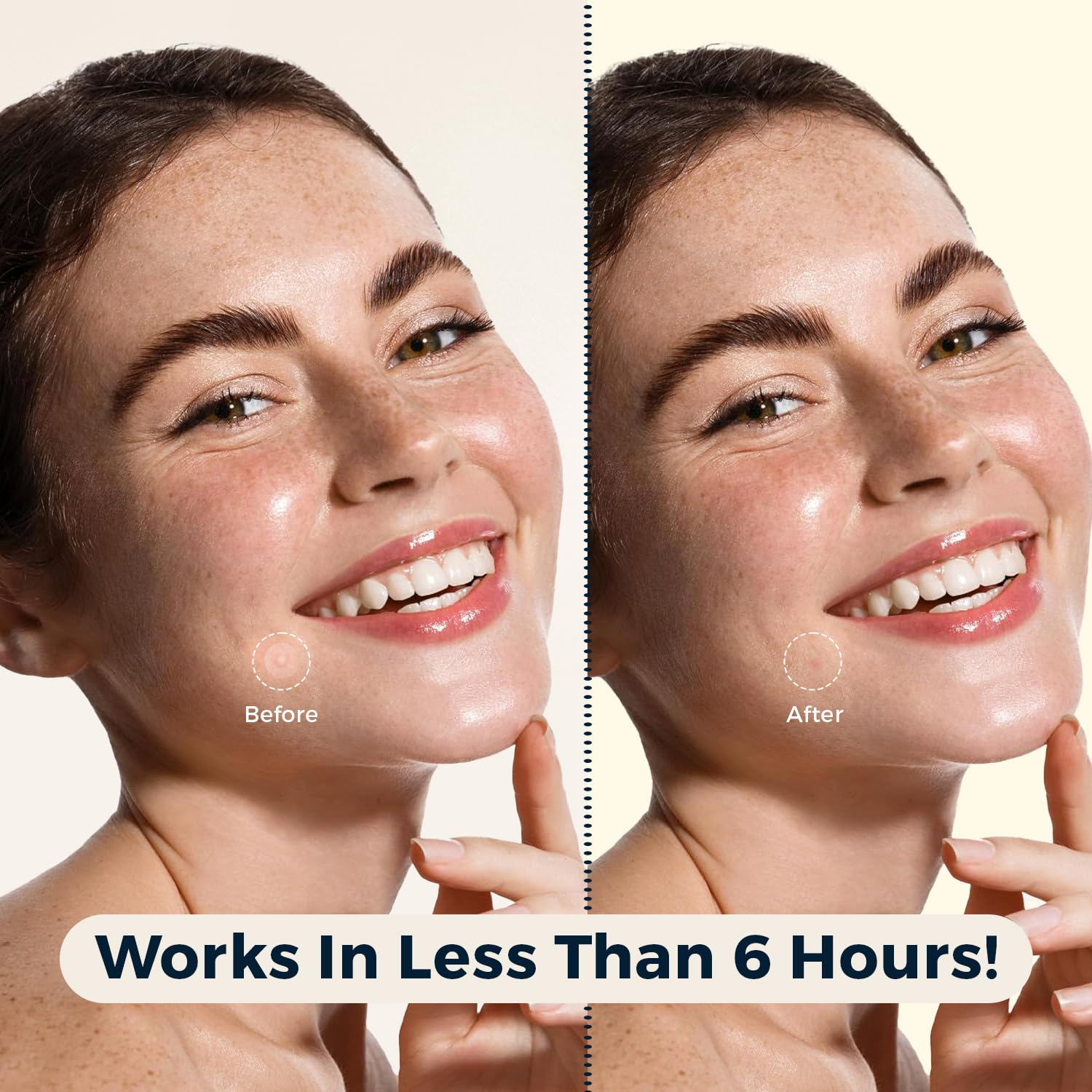 Blemish Spot