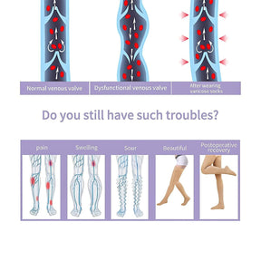 Medical Compression Stockings UK - Support Stockings 20-30 mmHg Graduated Support Socks Relief Calf Men Women
