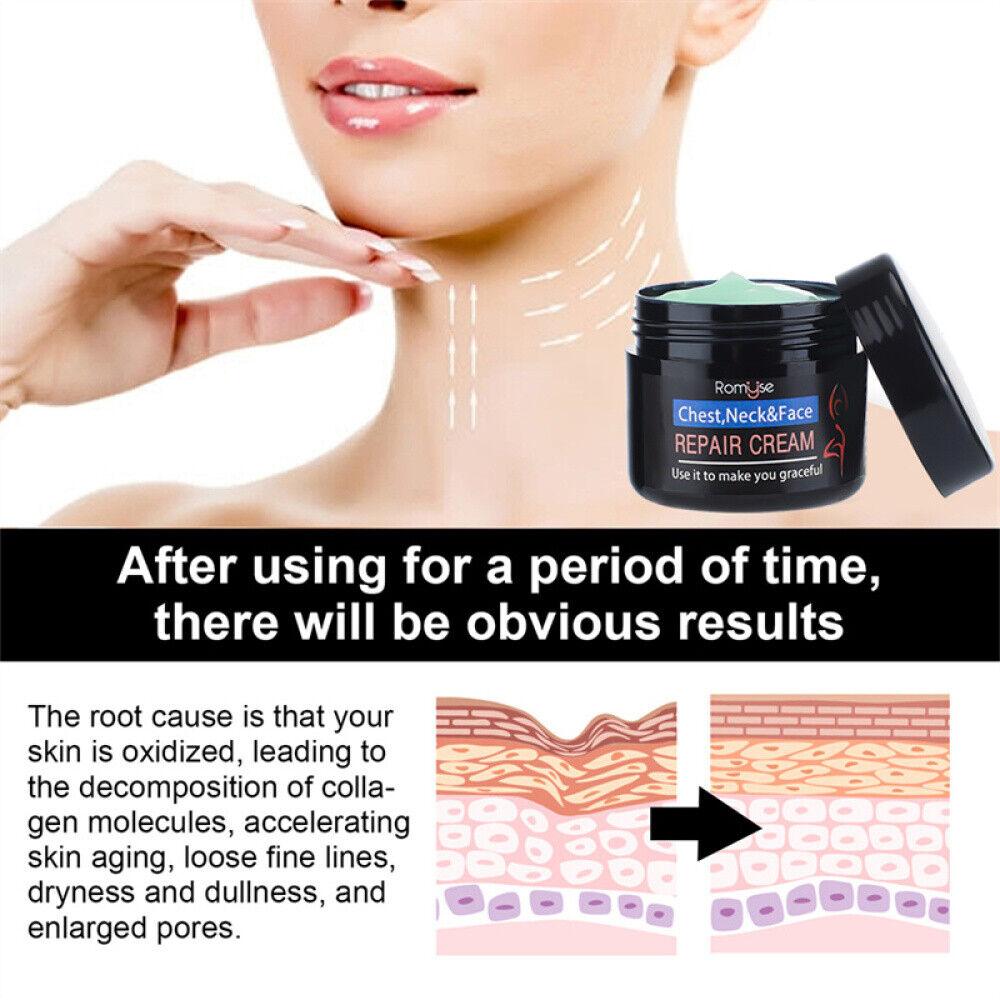 Neck Wrinkles Remover Cream