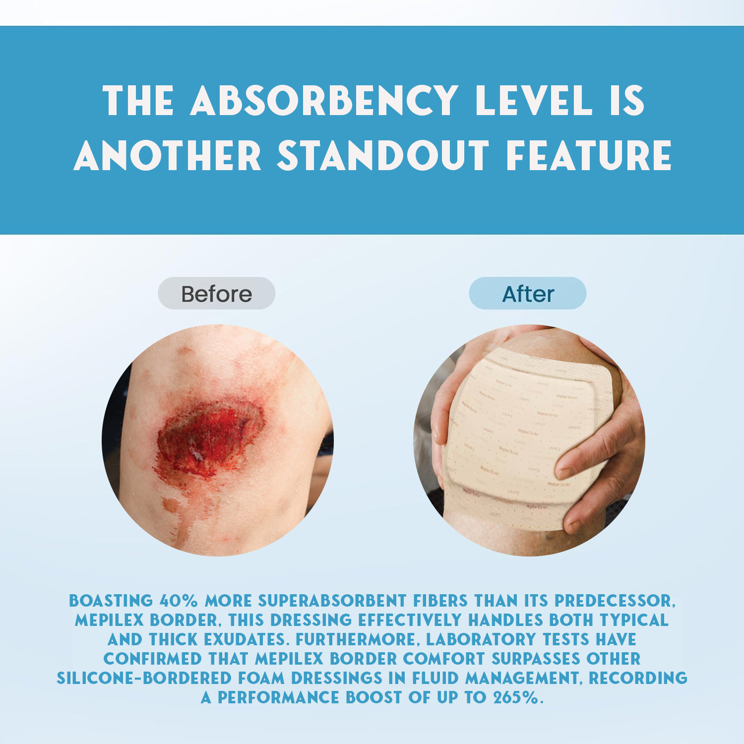 Non-stick wound dressing pads for first aid