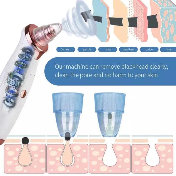 Pore Cleanser Vacuum