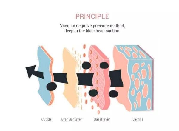 Pore Vacuum Cleaner