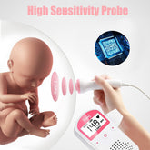 fetal heartbeat doppler