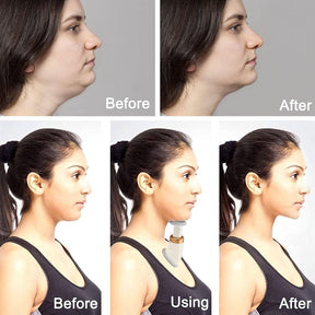 chin exercise machine