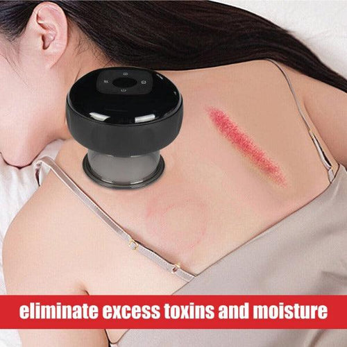 Using Cupping Machine Electric Cupping Machine - Professional Smart Cupping Device | Buy Now ...