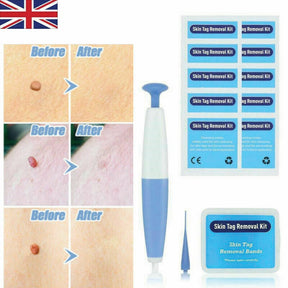 skin tag removal kit boots
